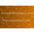 Human Primary Bladder Epithelial Cells